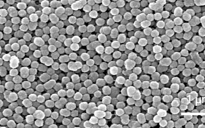 SEM-afbeelding (vergroting 20.000x), OMNICHROMA pasta, TOKUYAMA DENTAL