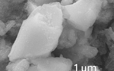 SEM-afbeelding (vergroting 20.000x), Venus Pearl One, Kulzer