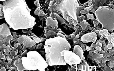 SEM-afbeelding (vergroting 20.000x) G-aenial Universal Flo, GC
