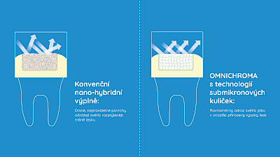Grafické porovnání barevné shody konvenčních kompozitů s OMNICHROMA