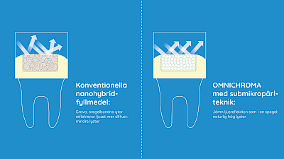 Grafisk jämförelse av färgmatchning av konventionella kompositer med OMNICHROMA